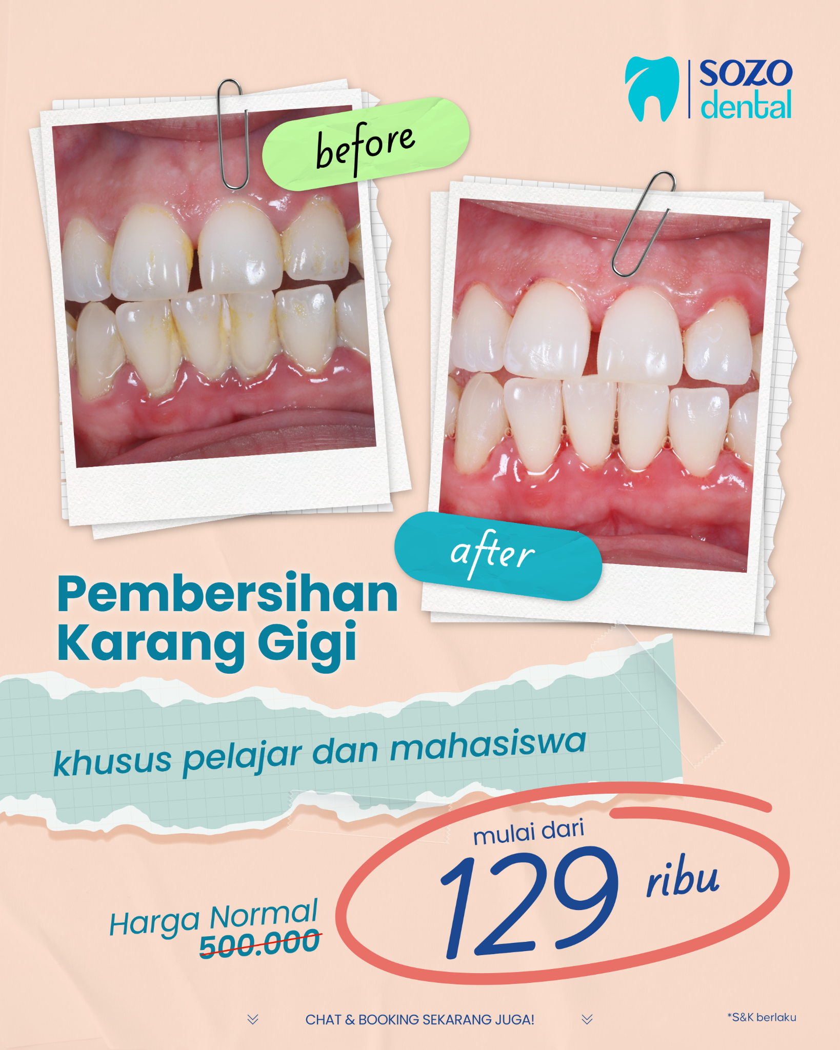 Sozo Dental Clinic Facebook ad