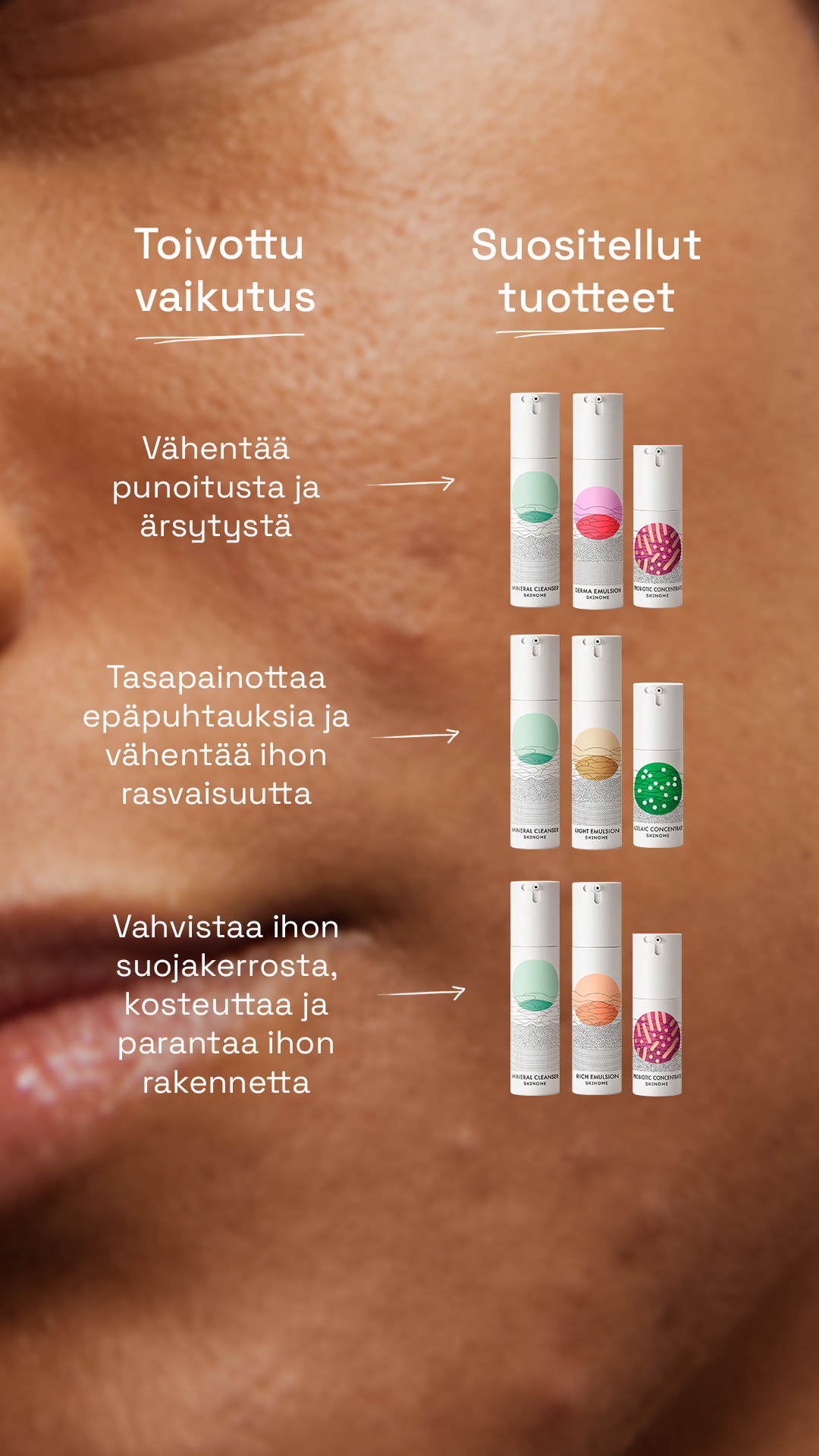 Skinome Facebook ad