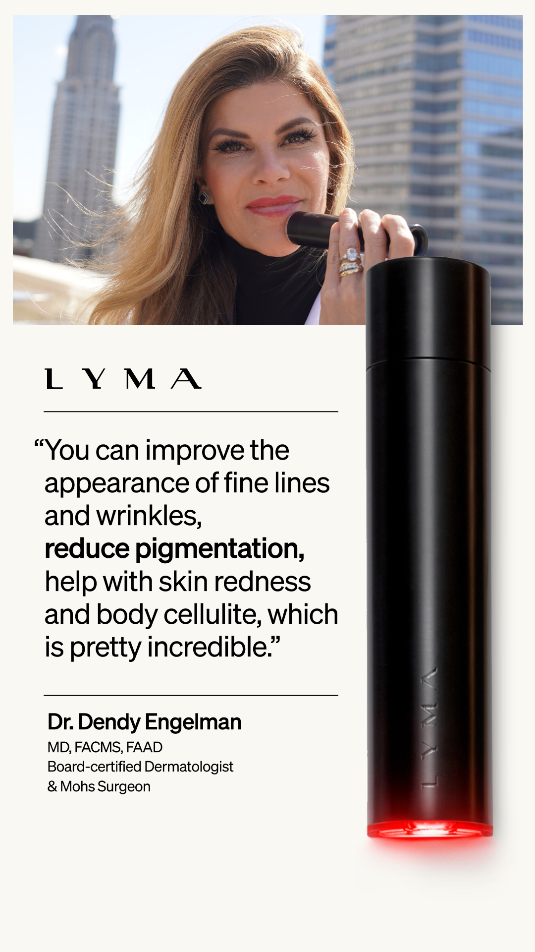 LYMA Facebook ad