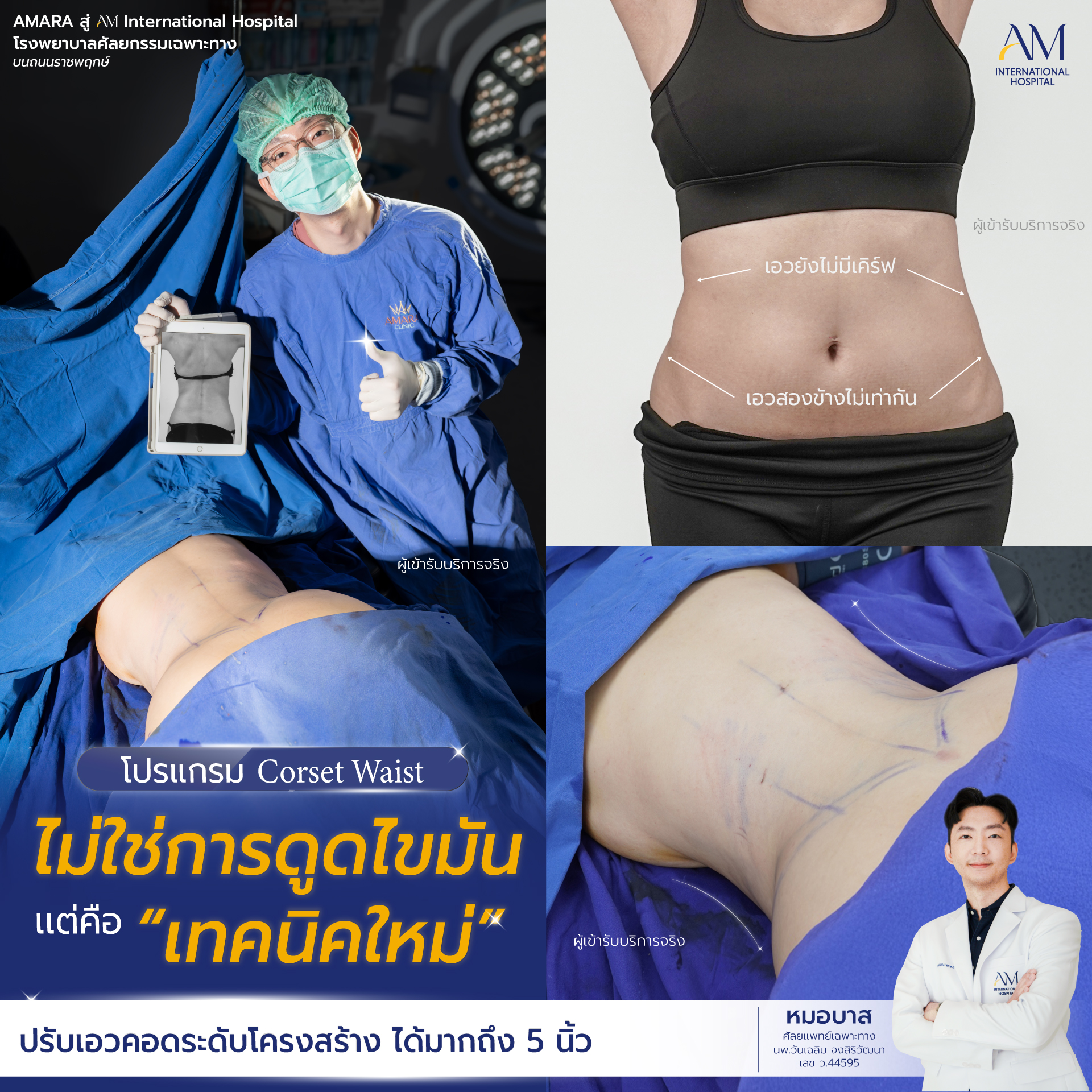 Body Contouring ศัลยกรรมตกแต่งหนังหน้าท้อง เสริมหน้าอกเฉพาะทาง Facebook ad