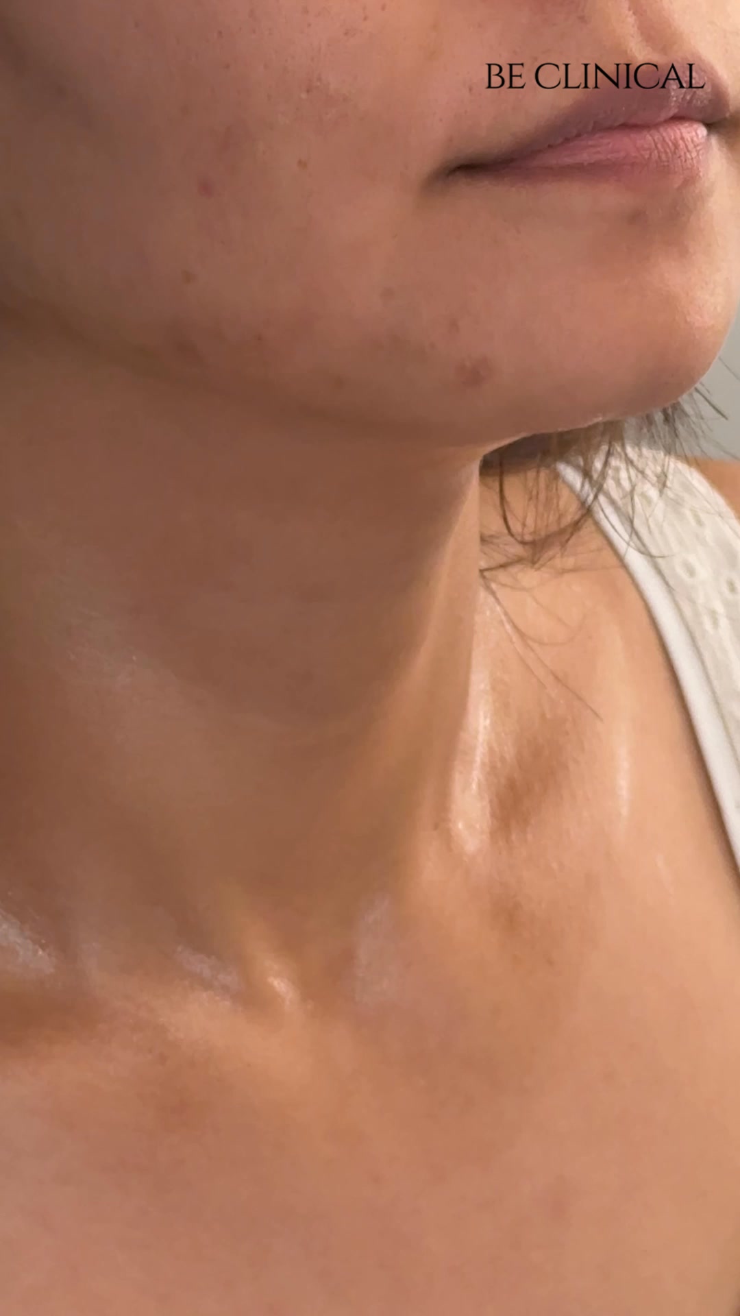 Be Clinical Facebook ad: Your Neck Deserves Better Care