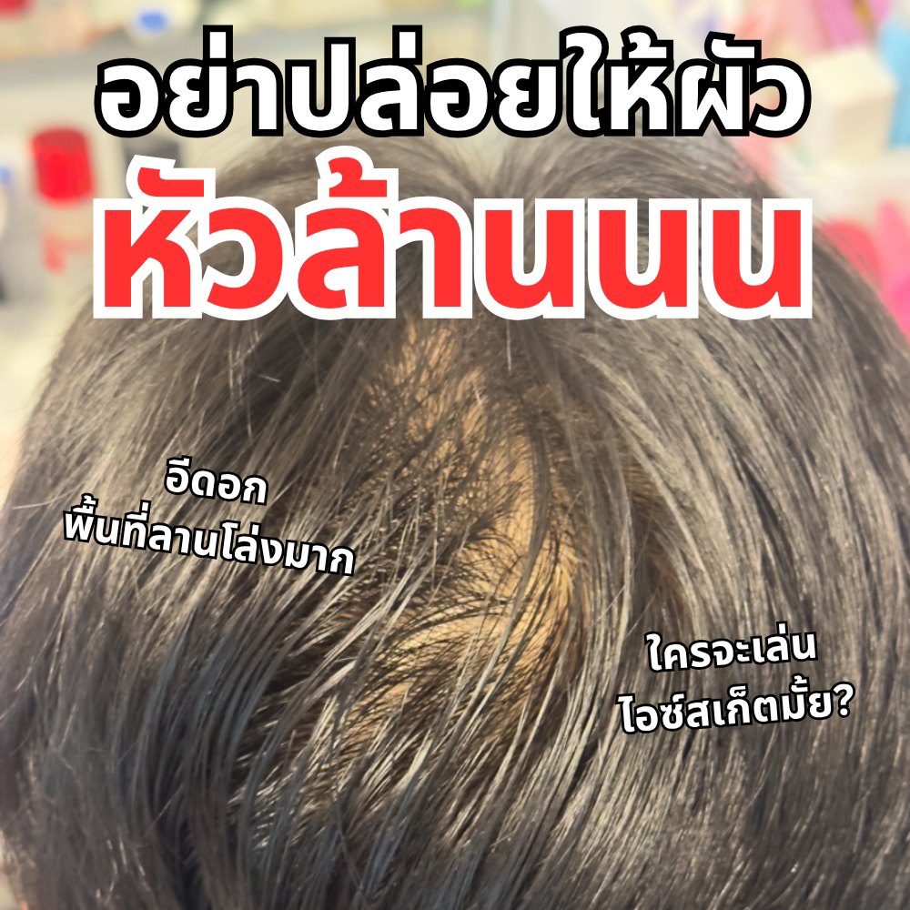 เก็บมาเล่า Facebook ad