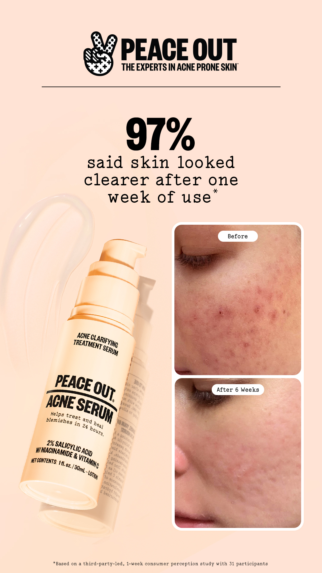 Peace Out Skincare Facebook ad