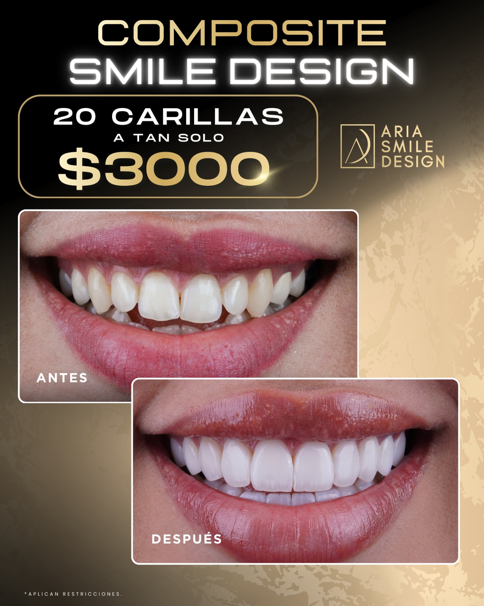 Aria Smile Design Facebook ad