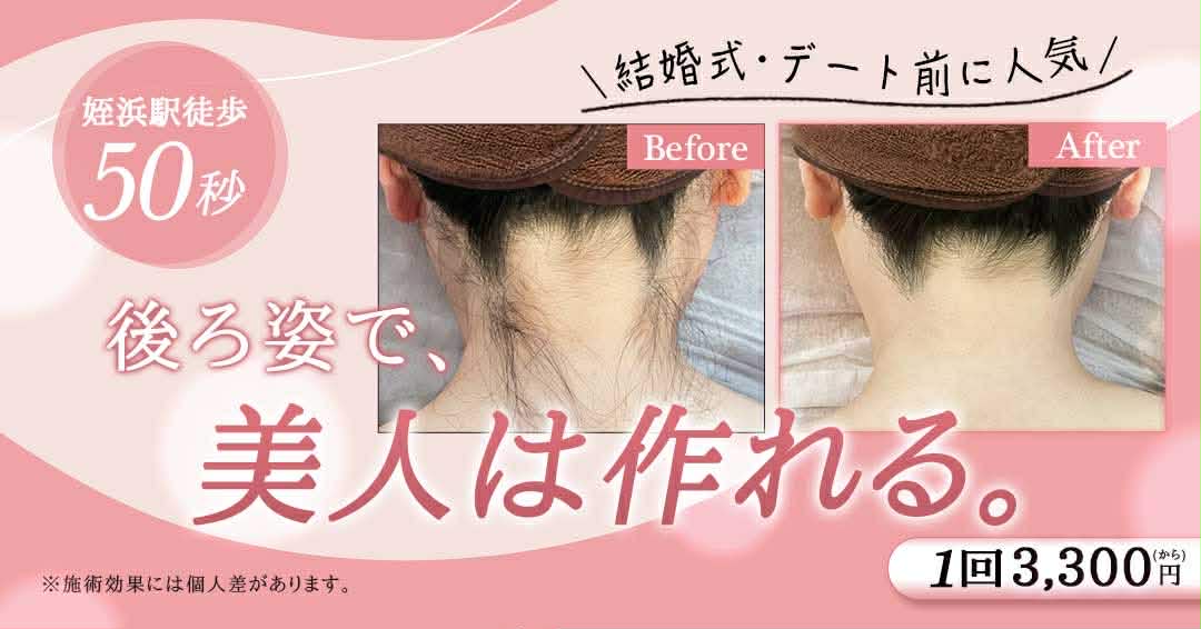 Nail salon&school bague - バーグ Facebook ad: 【初回3300円〜】うなじ専用ケア 【姪浜駅から徒歩50秒】すぐ行ける脱毛 【結婚式・デート前に人気】後ろ姿キレイに