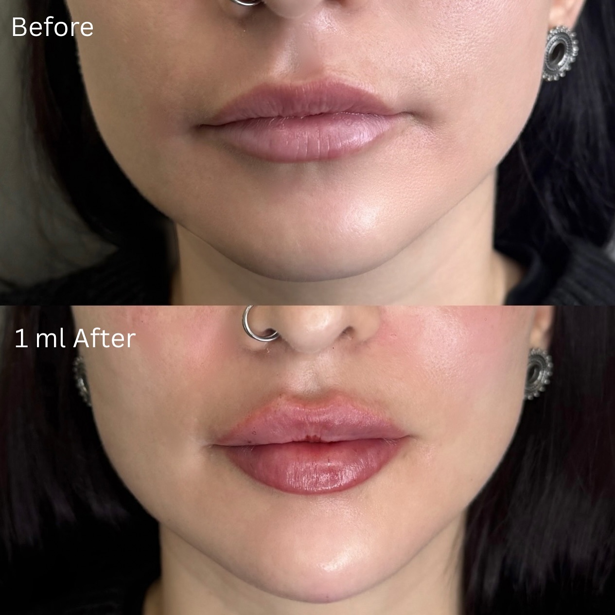 Naj Aesthetics Facebook ad: Prendre un rendez-vous chez Naj Aesthetics Montreal - 4150…