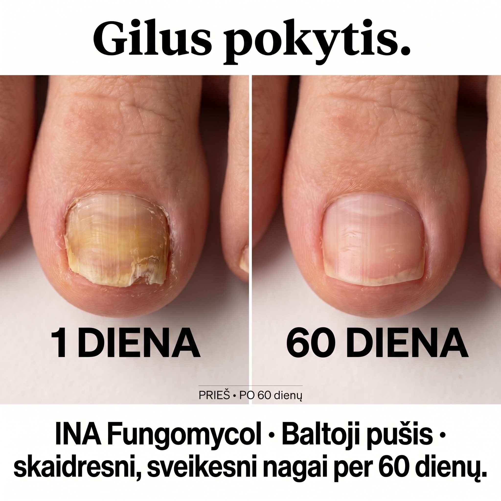 InaEssentials.lt - Organinė Kosmetika Facebook ad: 1 diena ir 60 diena: pamatyk skirtumą