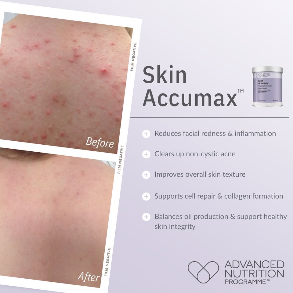 Advanced Nutrition Programme Singapore Facebook ad: Clear, Confident Skin from Within