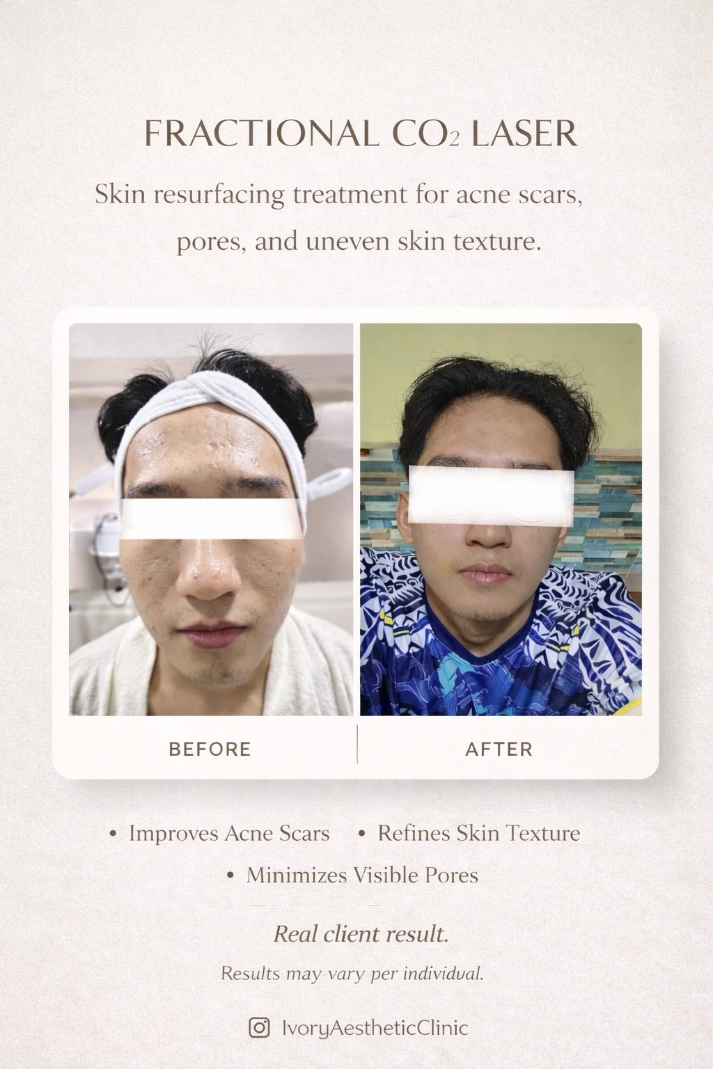 Ivory Aesthetic Clinic Facebook ad: IVORY Aesthetic Clinic