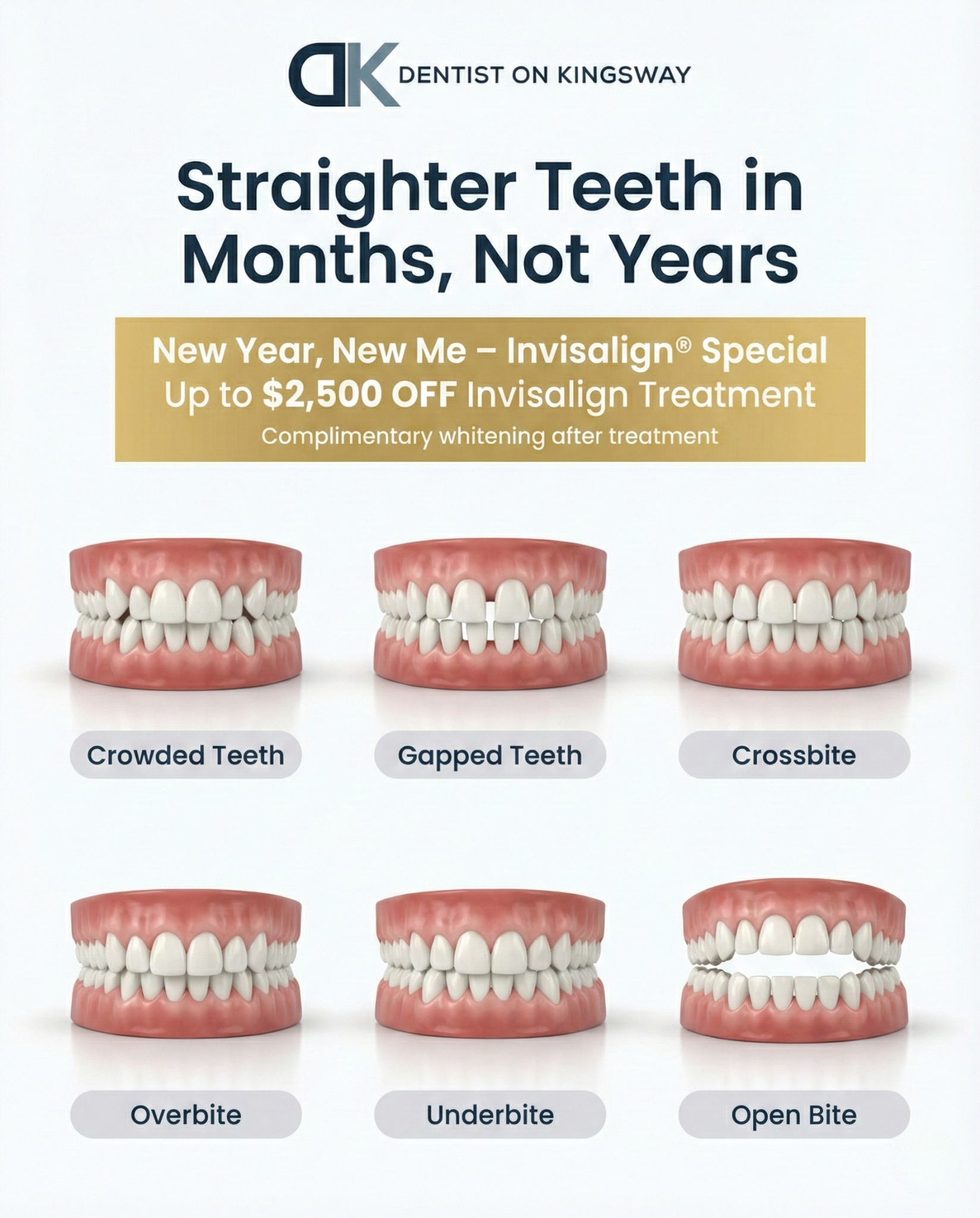 Dentist on Kingsway Facebook ad: New Year New Me, $2500 Savings on Invisalign