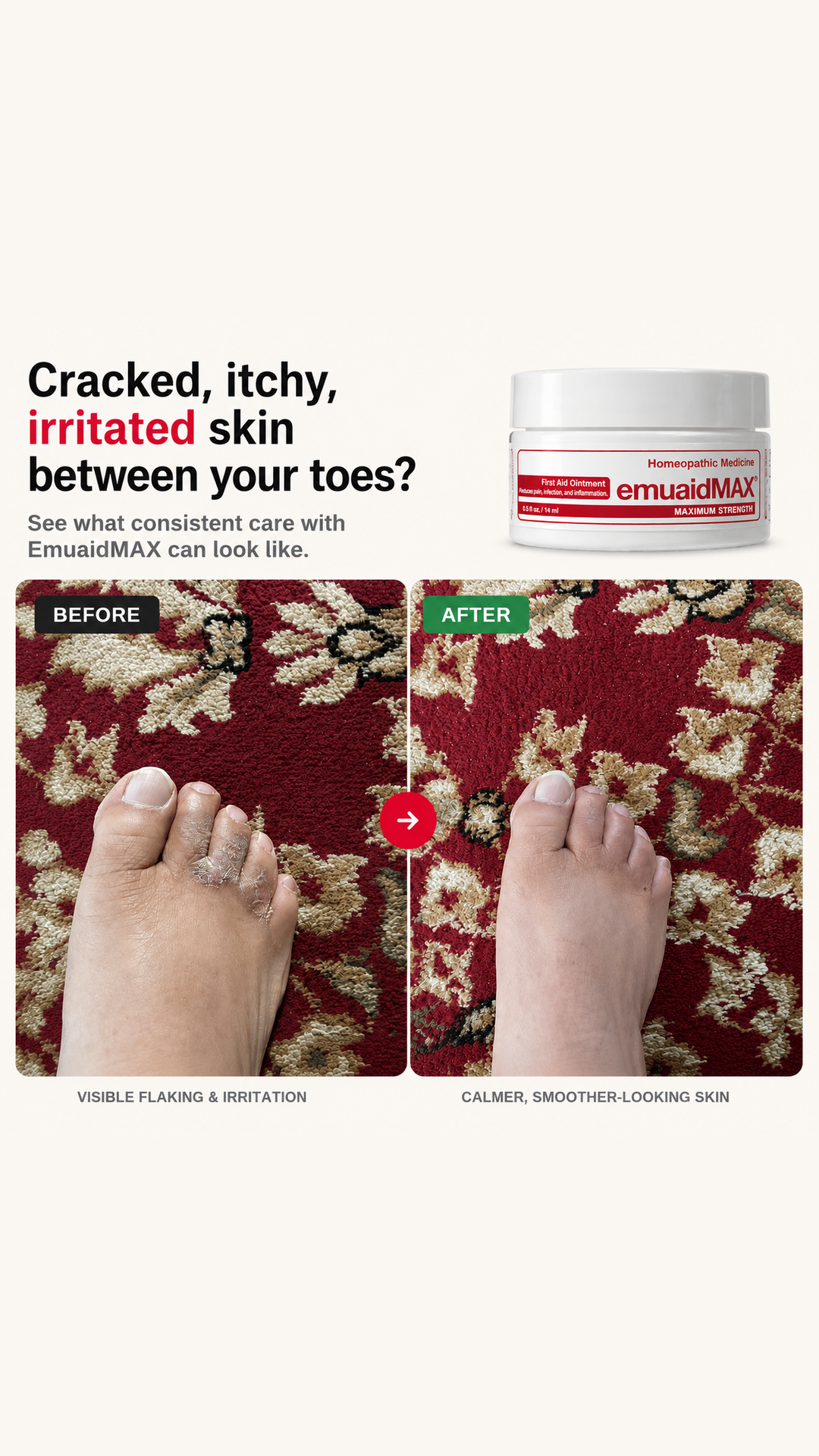 Emuaid Facebook ad