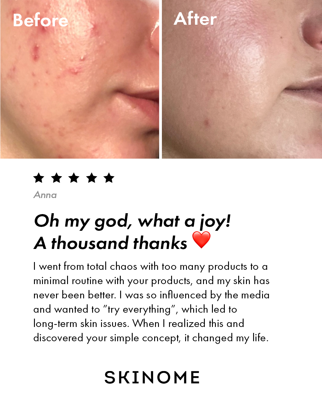 Skinome Facebook ad