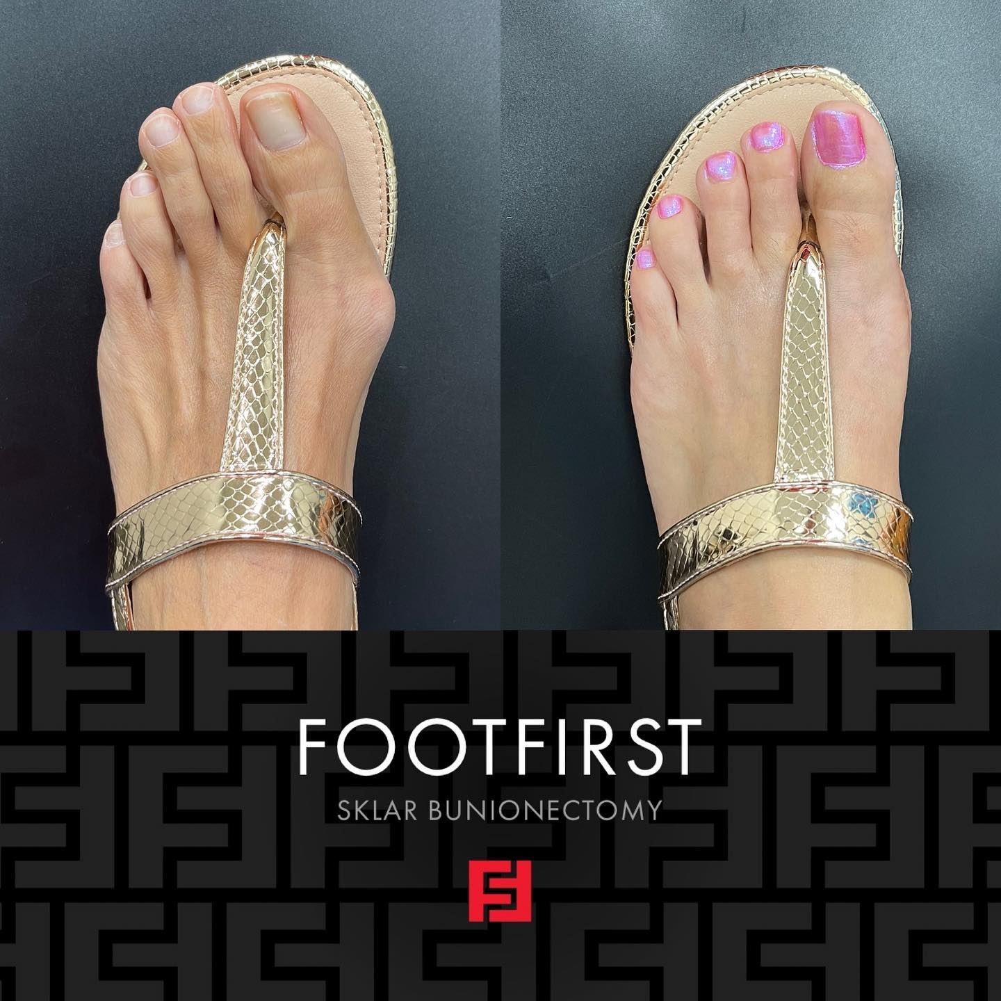 Foot First Podiatry Centers Facebook ad