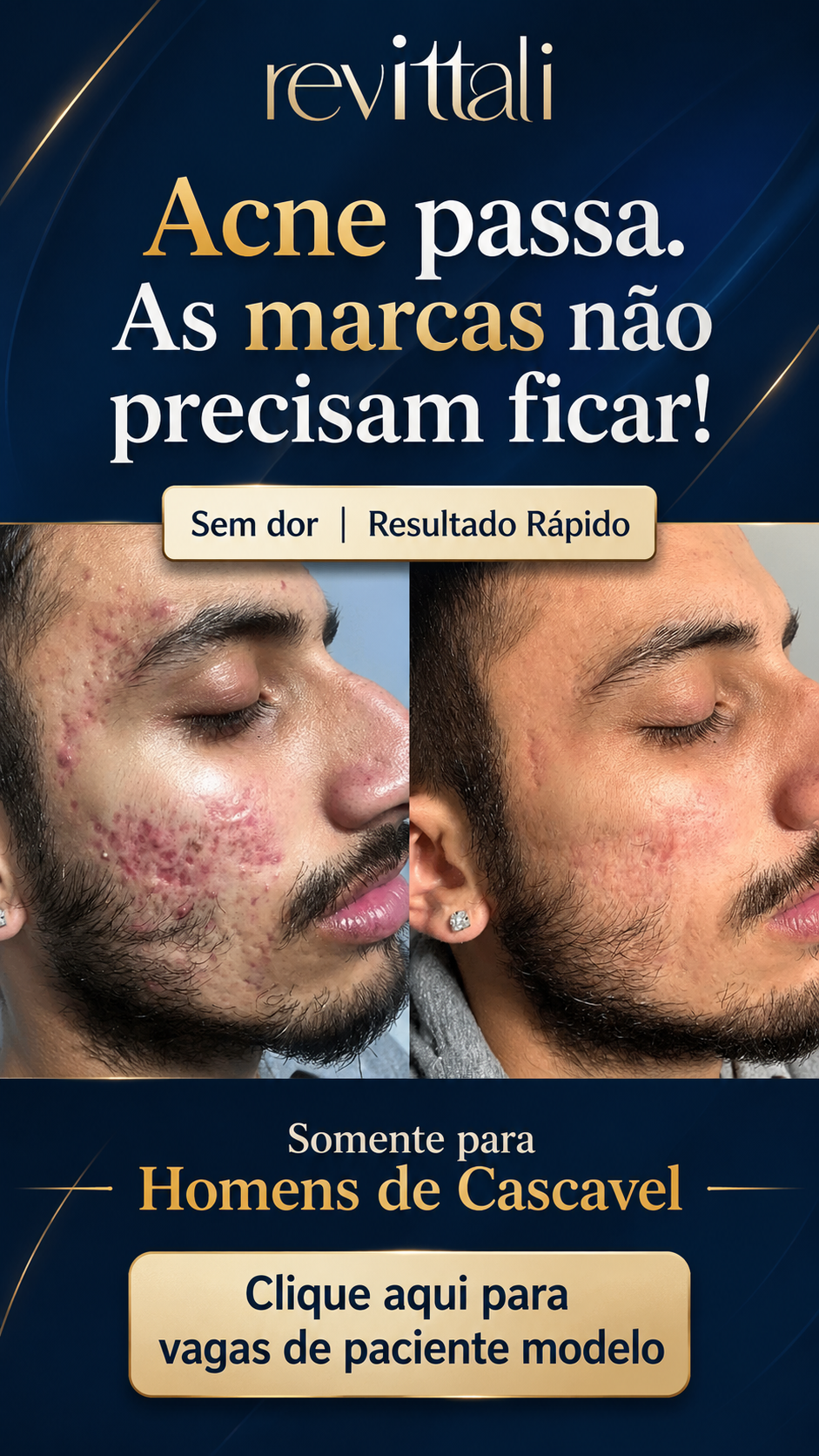 Revittali Facebook ad from May 17, 2026