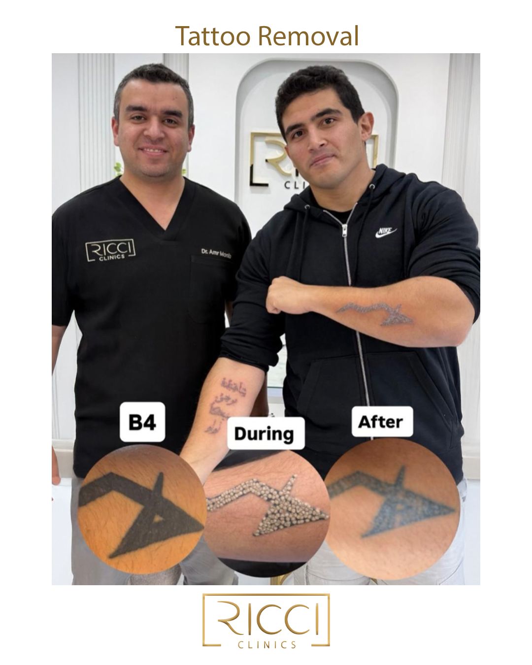 Ricci Aesthetic Clinics Facebook ad: Every tattoo tells a story, and some stories…