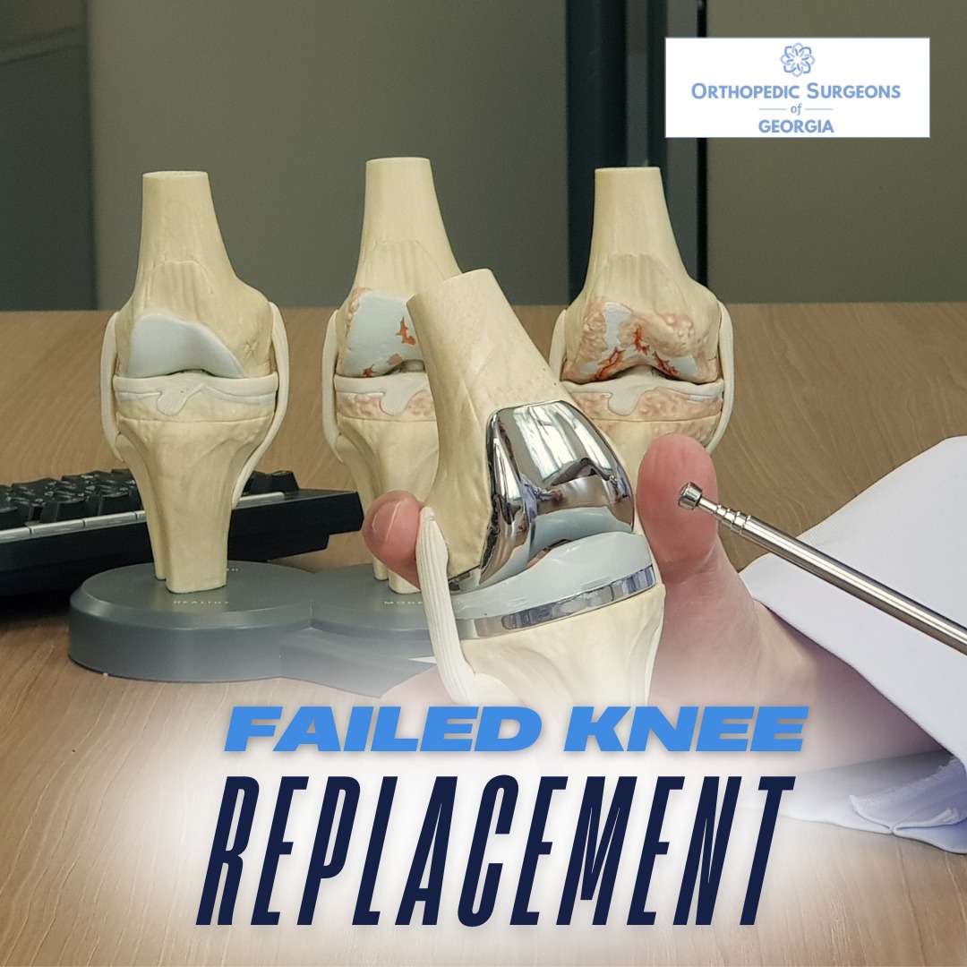 Orthopedic Surgeons of Georgia Facebook ad: Orthopedic Surgeons of Georgia | CRMC