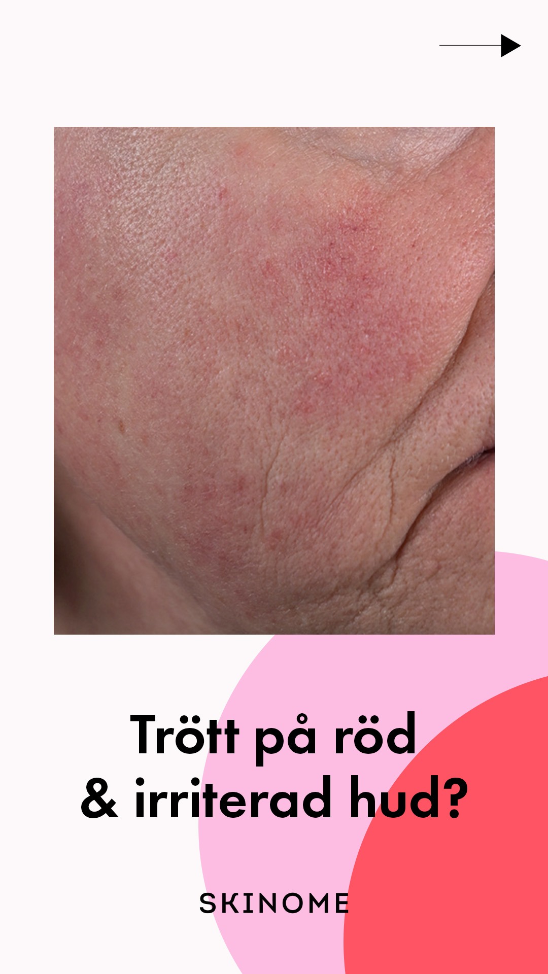 Skinome Facebook ad