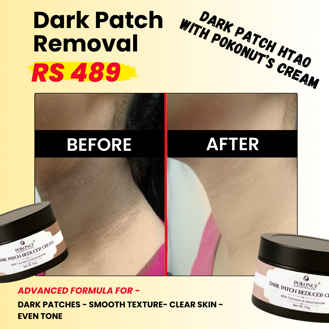 Pokonut Ayurveda  Facebook ad