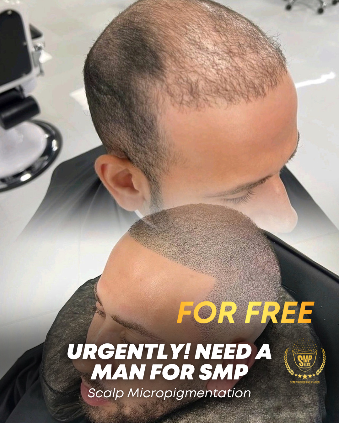 Сергей #Novoselya Facebook ad: MODEL ARANIYOR, ÜCRETSİZ SCALP MICROPIGMENTATION