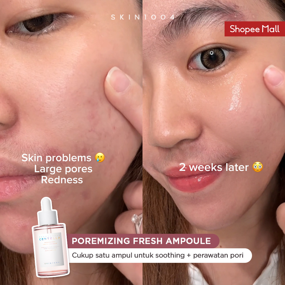 SKIN1004_Indonesia Facebook ad: Sekarang diskon 73%! Jangan sampai kelewatan