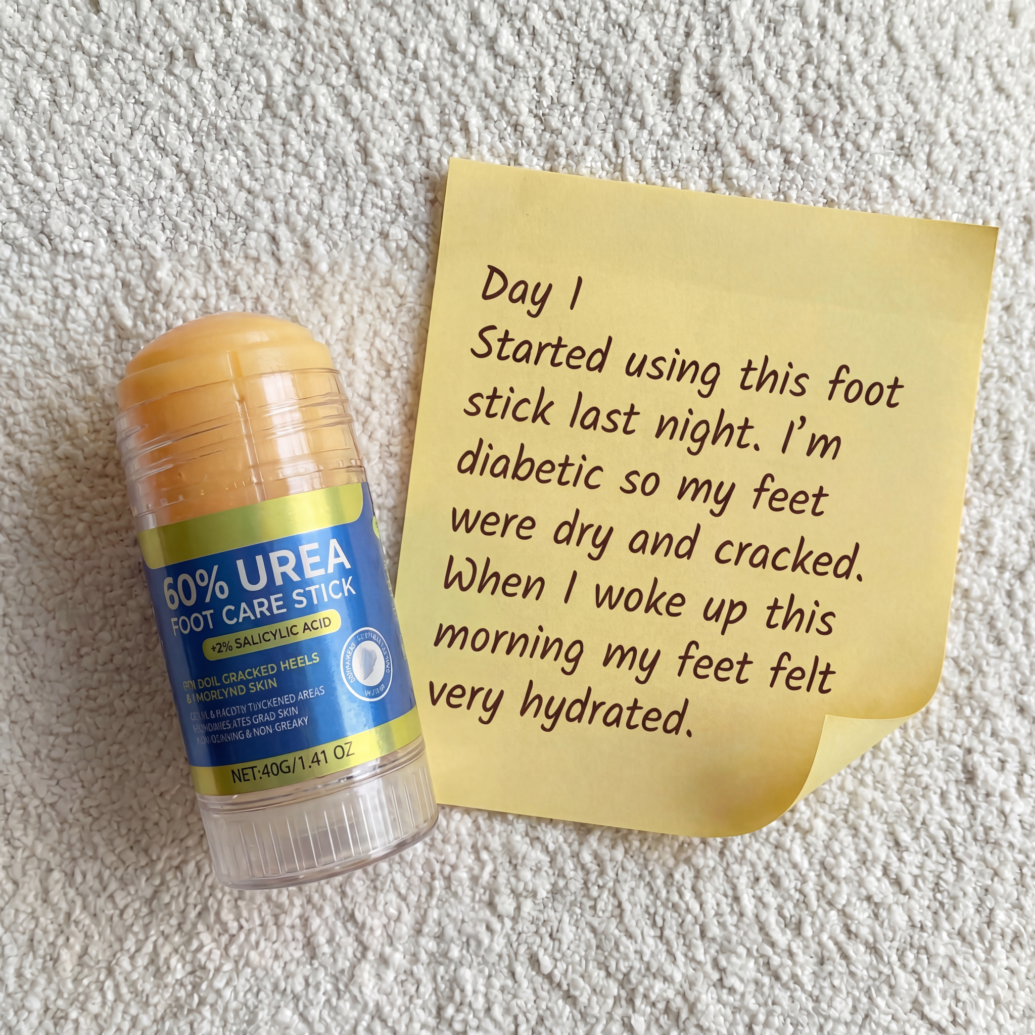 Foot Insiders Facebook ad: This is my experience trying urea for my…
