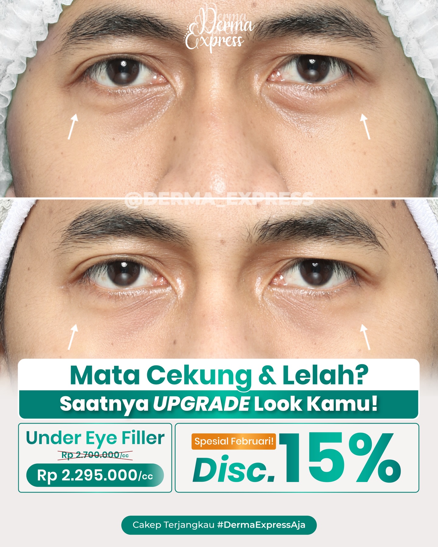 derma_express Facebook ad