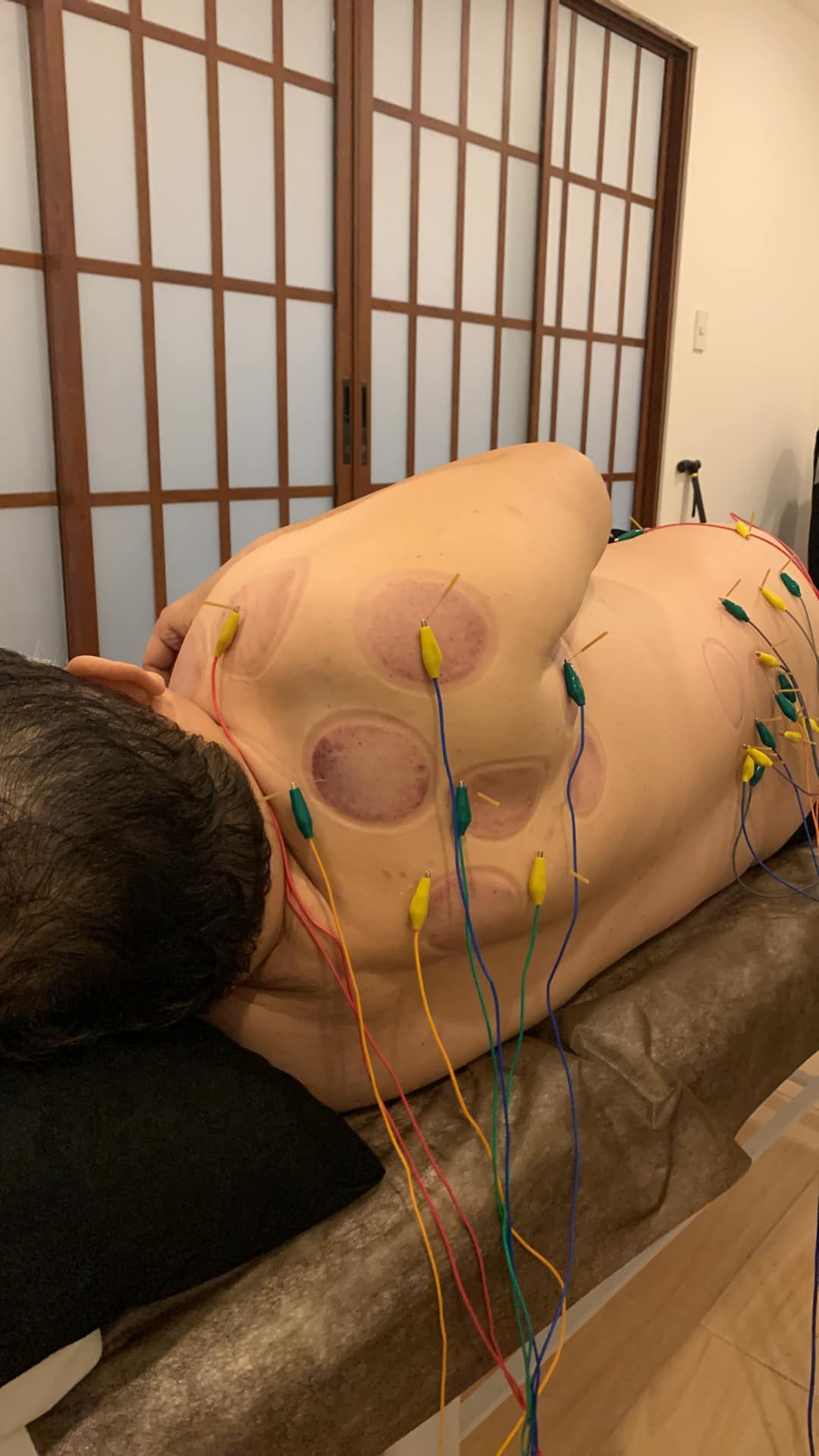 Cocona101 Japanese acupuncture clinic health & beauty Facebook ad