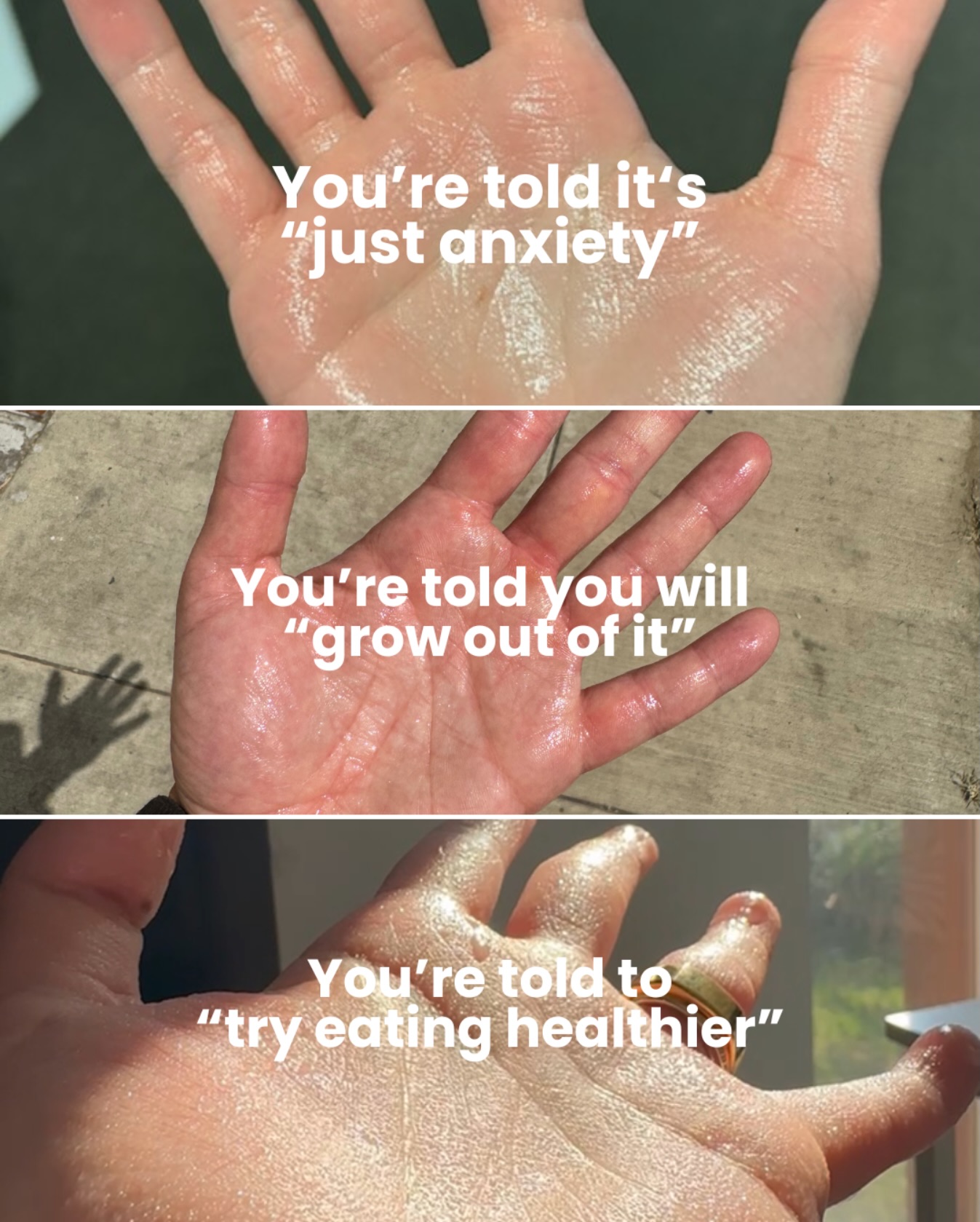 The Center For Hyperhidrosis Facebook ad: It’s not something you can control.