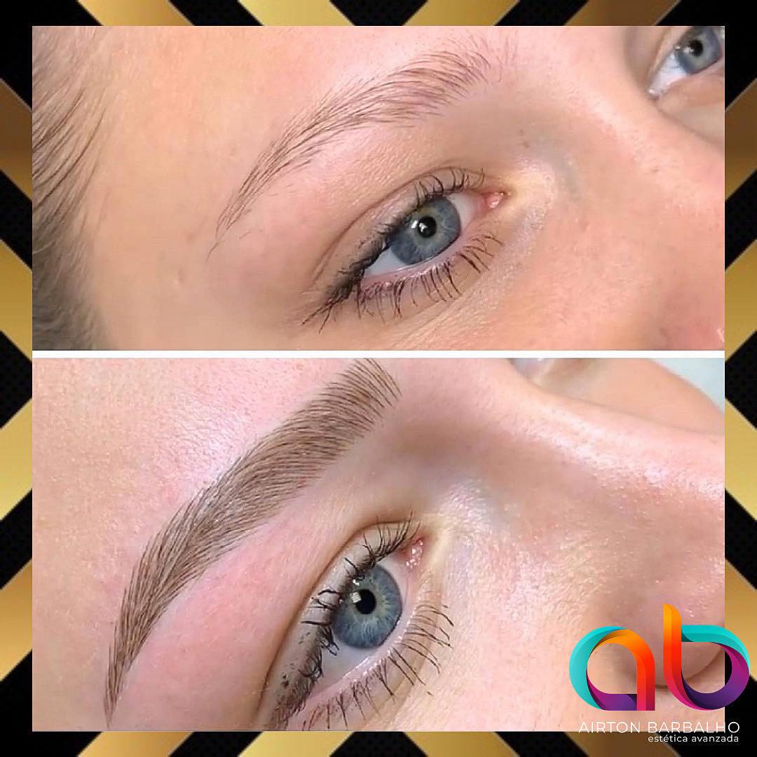 AB Estética Avanzada Facebook ad