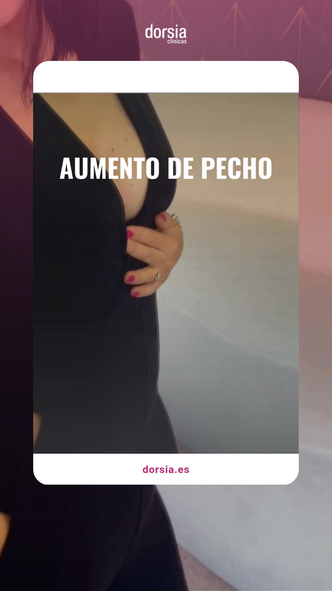 Clínicas Dorsia Facebook ad from Sep 14, 2026