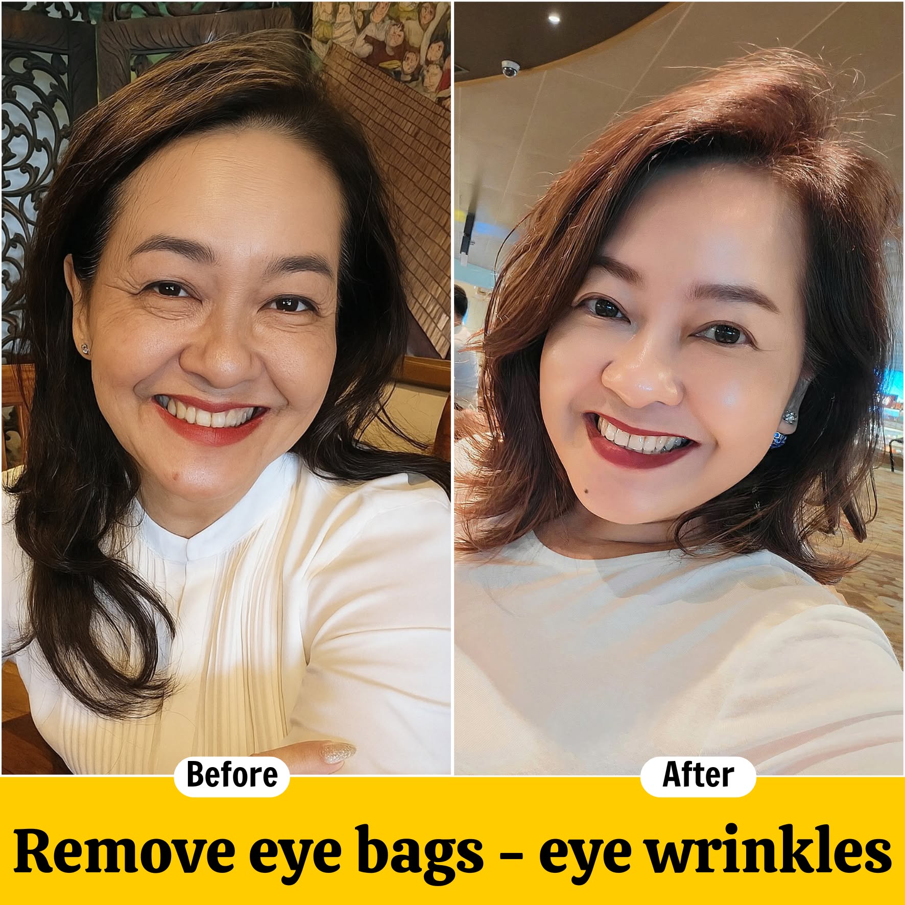 Korean Skin Rejuvenation Technology Facebook ad