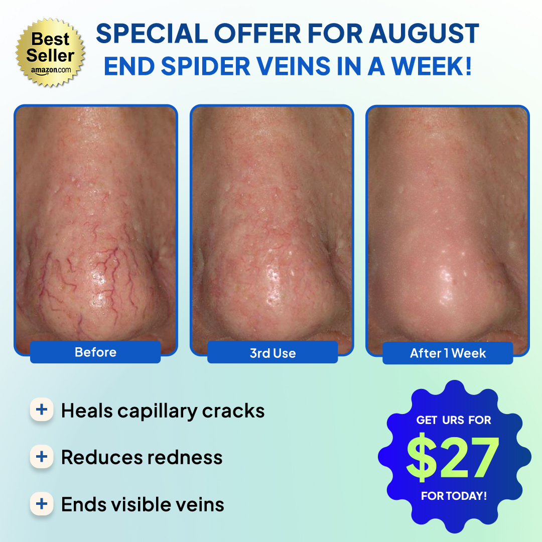 Anti-Redness US Facebook ad