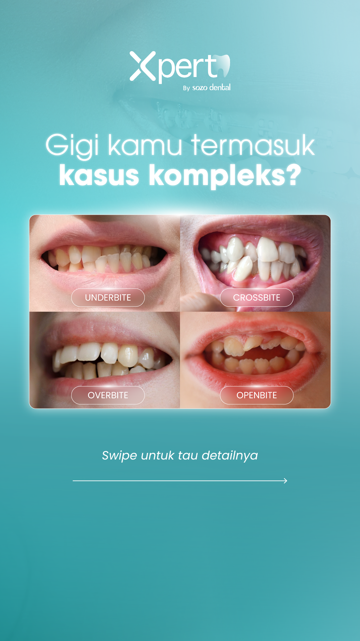 XPERT by Sozo Dental Clinic Facebook ad