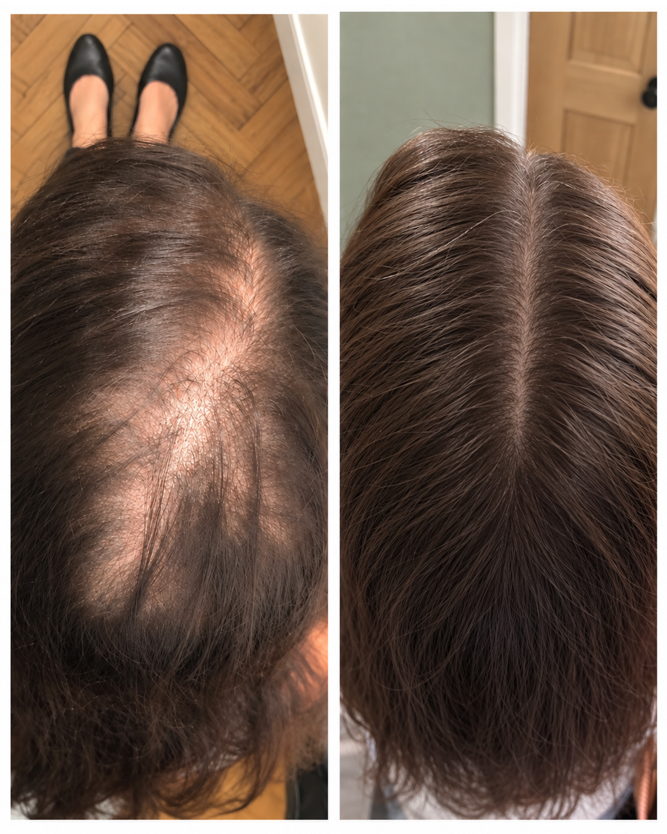 Dr. Patricia Sullivan Facebook ad: The reason why my patient was losing her hair