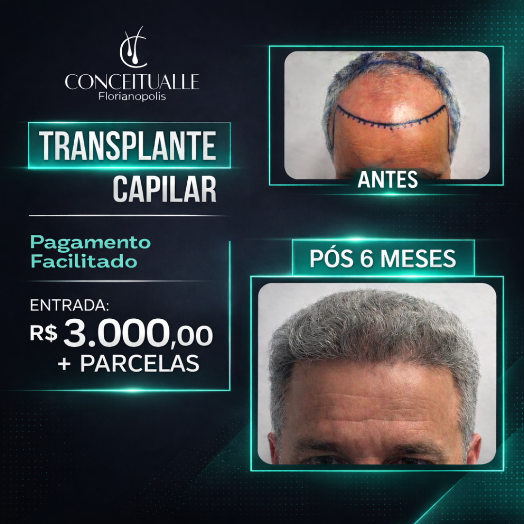 Clinica Conceitualle Facebook ad: Transplante Capilar com Pagamento Facilitado