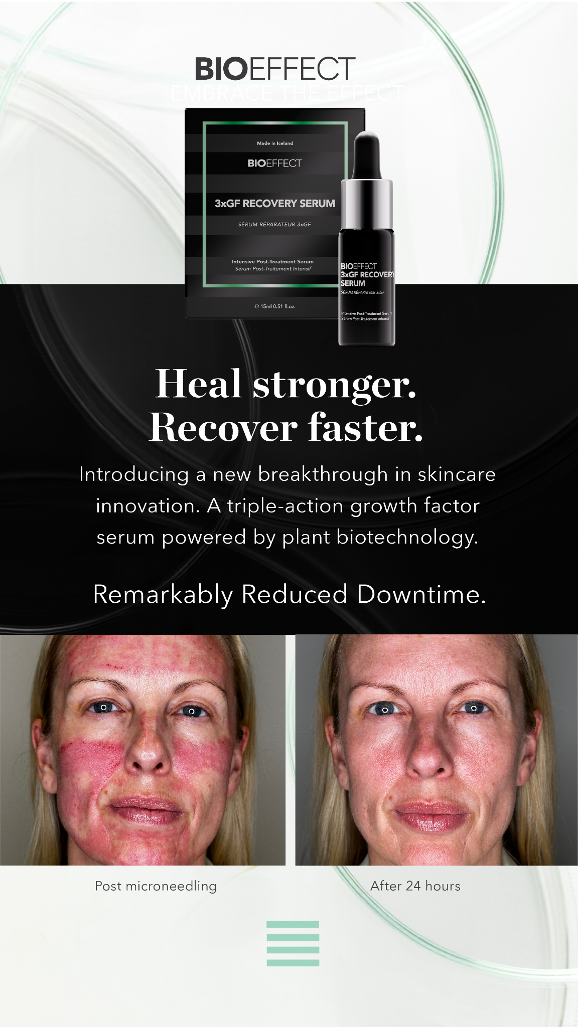 BIOEFFECT Facebook ad