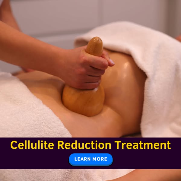 Bright Mind Facebook ad: Cellulite Reduction Treatments - Understanding Options