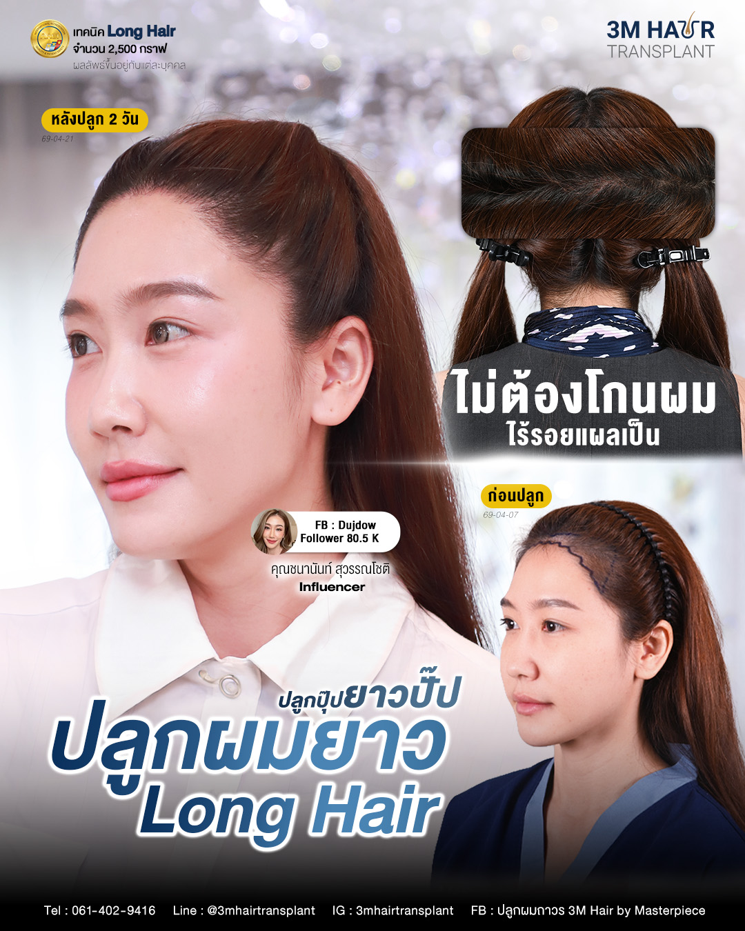 Masterpiece Hospital Facebook ad: ผมสวยไม่ใช่เรื่องบังเอิญ