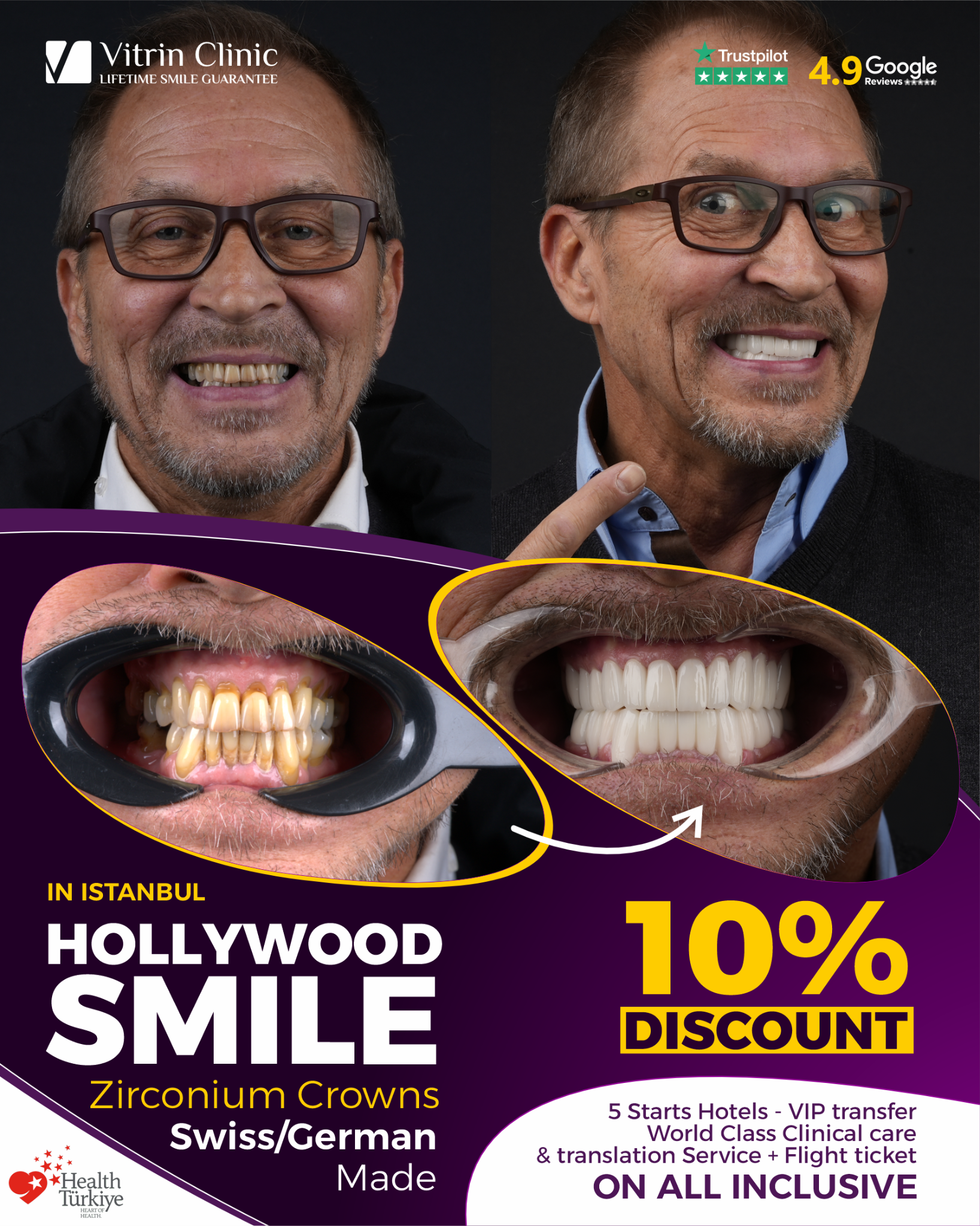 Vitrin Dental Clinic Facebook ad