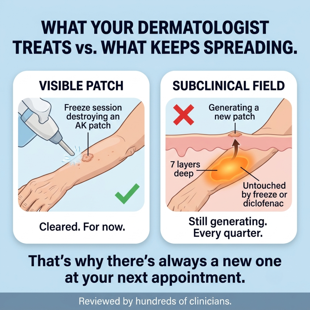 Actinic Keratosis Reset Facebook ad