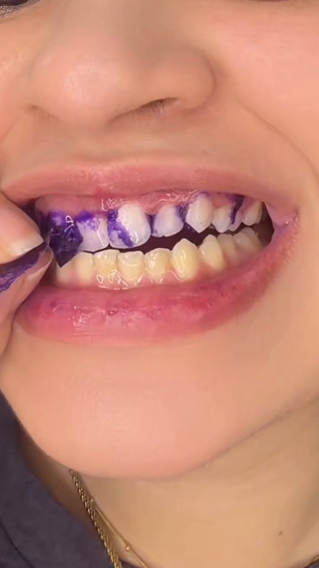 Mad Dental Care Facebook ad: Transparent Marketing Only