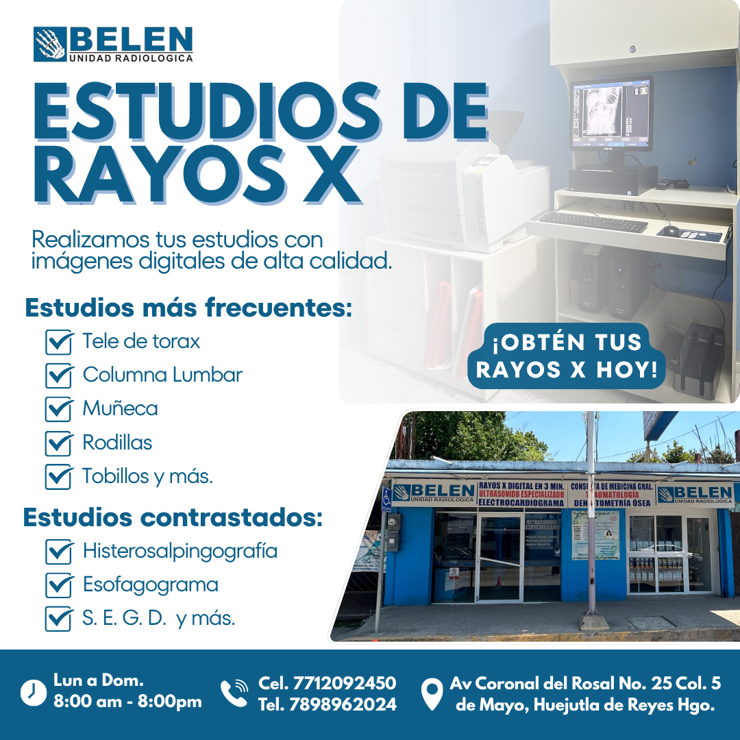 Unidad Radiológica Belén Huejutla Facebook ad: Unidad Radiológica Belén, donde la tecnología y la…