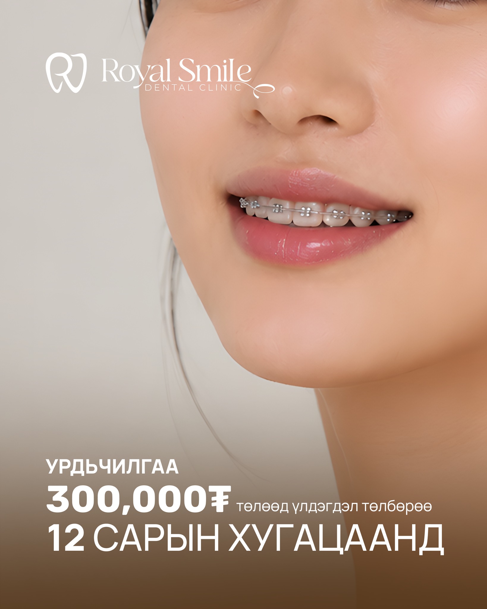 24 Цагийн шүдний эмнэлэг Royal Smile Dental Clinic Facebook ad: Өөртөө итгэлтэй инээмсэглэлээ өнөөдрөөс эхлүүлээрэй