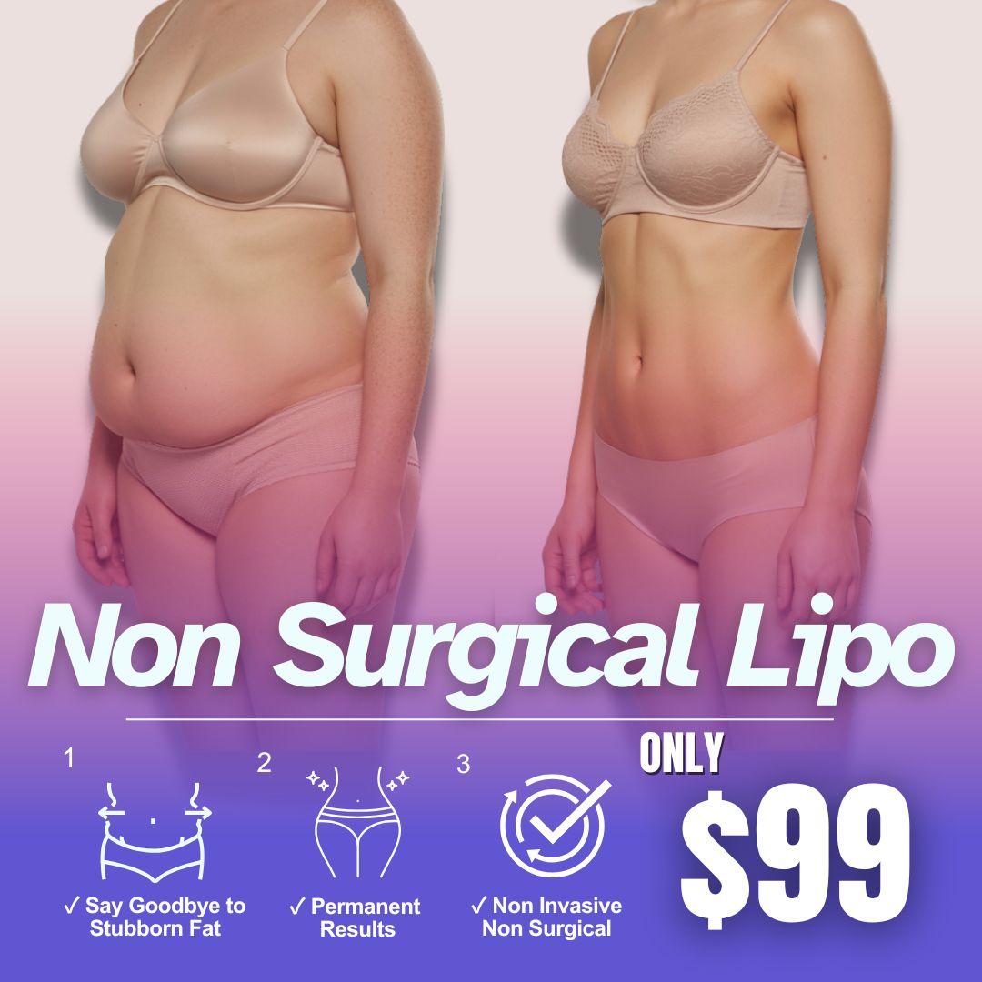 The Beauty Plug San Diego Spa Facebook ad: Non Surgical Lipo NOW $99