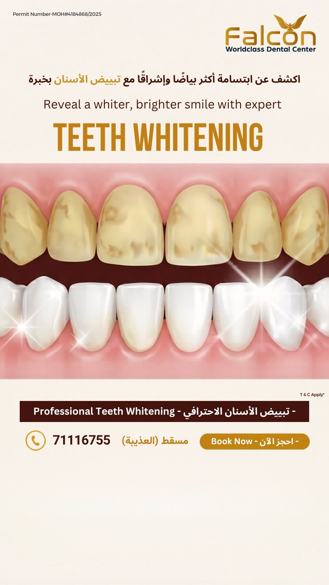Falcon Dental Center Facebook ad: Professional Teeth Whitening