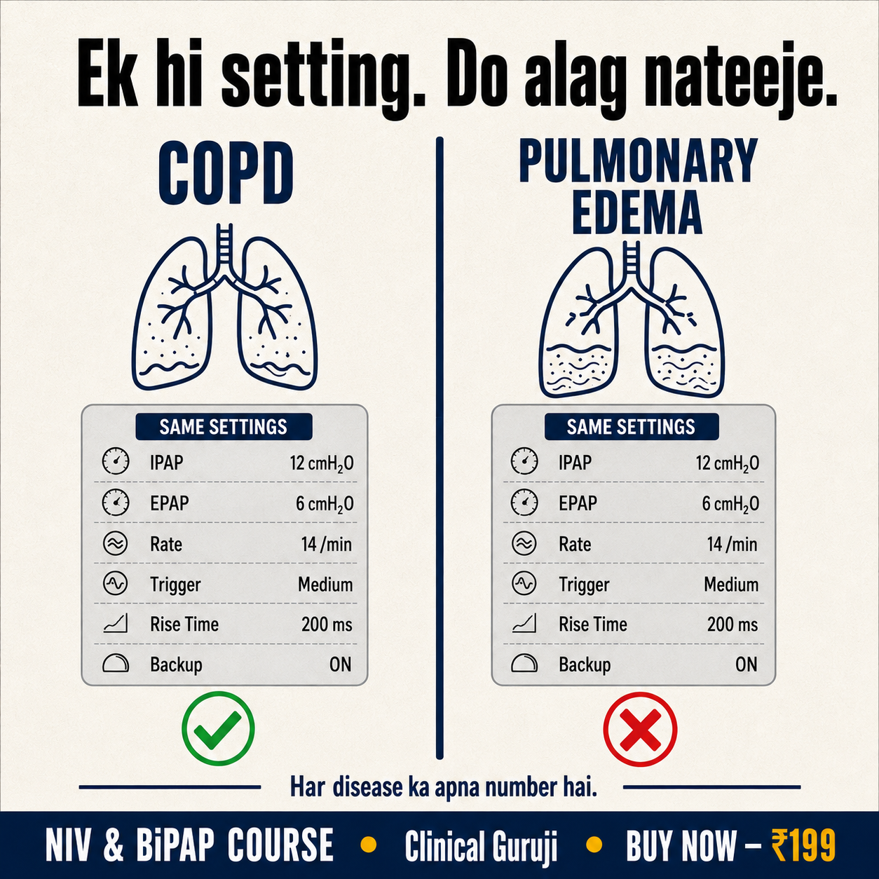 Entice Facebook ad: NIV Sirf Mask Lagana Nahi Hai