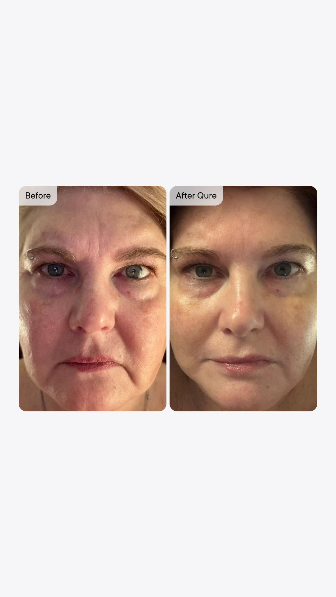 Qure Skincare Facebook ad