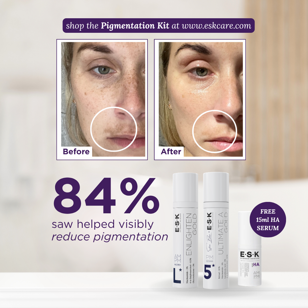 ESK  Evidence Skincare Facebook ad