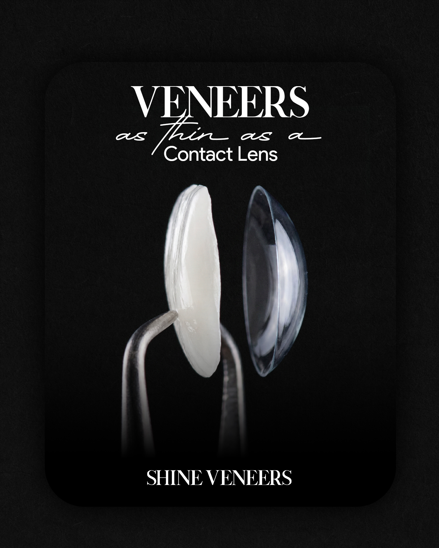 Shine Veneers Facebook ad: Shine Veneers - A new way to transform your smile