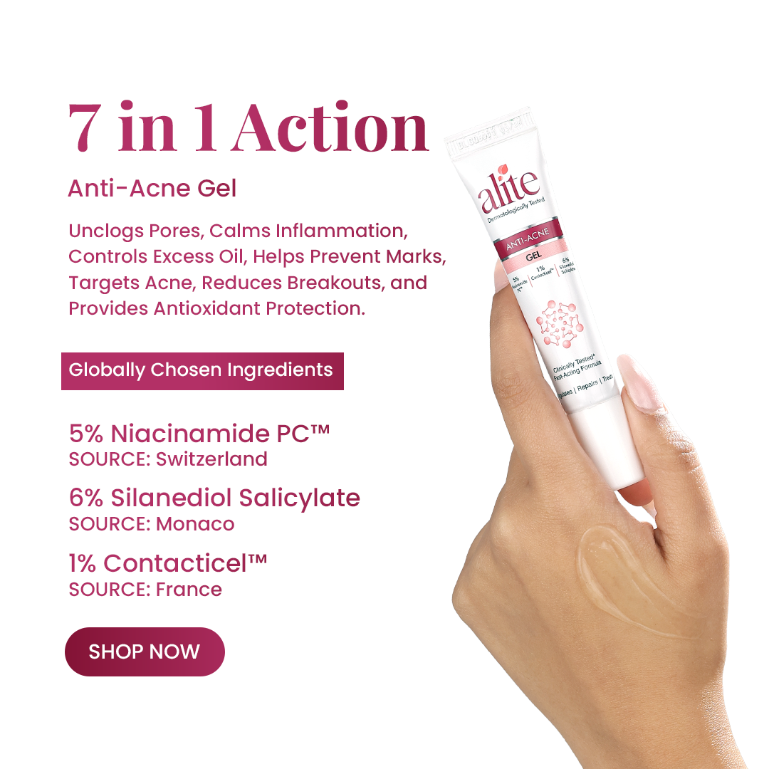 Anushka Sen Facebook ad: Treat Acne Beyond Just Pimples